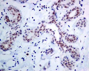 IHC of paraffin-embedded human breast tissue using anti-SF3A1 antibody.