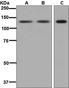 Western blot analysis on (A) HeLa, (B) lymph node, and (C) K562 cell lysates using anti-SF3A1 antibody.