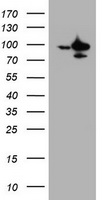 HEK293T cells were transfected with the pCMV6-ENTRY control (Left lane) or pCMV6-ENTRY SF3A1 (Right lane) cDNA for 48 hrs and lysed. Equivalent amounts of cell lysates (5 ug per lane) were separated by SDS-PAGE and immunoblotted with anti-SF3A1.