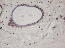 IHC of paraffin-embedded Human breast tissue using anti-SF3A1 mouse monoclonal antibody.
