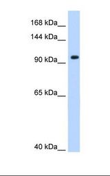 721_B cell lysate. Antibody concentration: 0.25 ug/ml. Gel concentration: 8%.