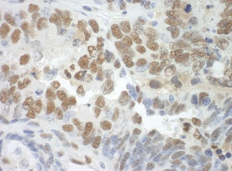 Detection of Mouse SF3A3 by Immunohistochemistry. Sample: FFPE section of mouse teratoma. Antibody: Affinity purified rabbit anti-SF3A3 used at a dilution of 1:250.