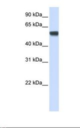 Fetal muscle lysate. Antibody concentration: 1.0 ug/ml. Gel concentration: 12%.