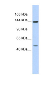 SF3B1 antibody LS-C110560 Western blot of HeLa lysate.