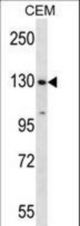 SF3B1 Antibody western blot of CEM cell line lysates (35 ug/lane). The SF3B1 antibody detected the SF3B1 protein (arrow).