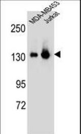 SF3B3 Antibody western blot of MDA-MB453,Jurkat cell line lysates (35 ug/lane). The SF3B3 antibody detected the SF3B3 protein (arrow).