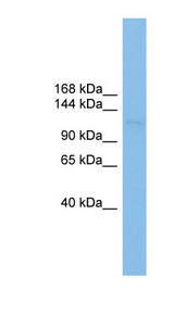 SF3B3 antibody LS-C116181 Western blot of HCT15 cell lysate.