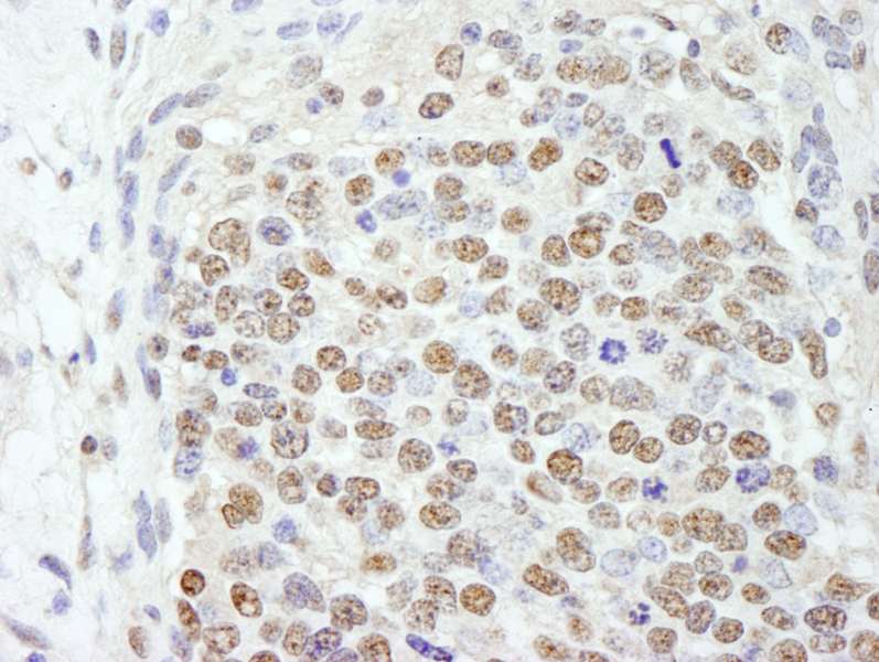 Detection of Mouse SF3b145/SAP145 by Immunohistochemistry. Sample: FFPE section of mouse teratoma. Antibody: Affinity purified rabbit anti-SF3b145/SAP145 used at a dilution of 1:250.