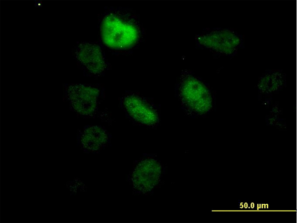 Immunofluorescence of monoclonal antibody to SF3B2 on HeLa cell. [antibody concentration 60 ug/ml]