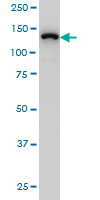 SF3B2 monoclonal antibody (M01), clone 5D2 Western blot of SF3B2 expression in HeLa NE.