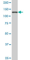 SF3B2 monoclonal antibody (M01), clone 5D2. Western blot of SF3B2 expression in NIH/3T3.