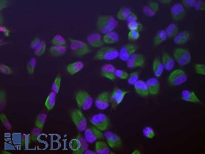 Human HeLa cells stained with SF3B4 antibody (red), chicken antibody to vimentin (green) and DNA (blue, stained with DAPI). The SF3B4 antibody antibody reveals strong granular nuclear staining which is a little different from the DNA stain and presumably reflects splicosomal complexes. The vimentin antibody stains the cytoplasmic intermediate filament network of the HeLa cells.