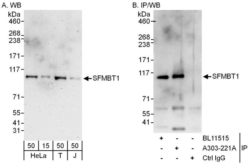Detection of Human SFMBT1 by Western Blot and Immunoprecipitation. Samples: Whole cell lysate from HeLa (15 and 50 ug for WB; 1 mg for IP, 20% of IP loaded), 293T (T; 50 ug) and Jurkat (J; 50 ug) cells. Antibodies: Affinity purified rabbit anti-SFMBT1 antibody used for WB at 0.1 ug/ml (A) and 1 ug/ml (B) and used for IP at 6 ug/mg lysate. SFMBT1 was also immunoprecipitated by rabbit anti-SFMBT1 antibody BL11515, which recognizes an upstream epitope. Detection: Chemiluminescence with exposure times of 3 minutes (A) and 30 seconds (B).