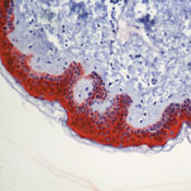 Formalin-fixed, paraffin-embedded human skin stained with peroxidase-conjugate and AEC chromogen. Note cytoplasmic staining of epidermis.