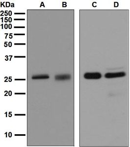 Western blot analysis on (A) fetal lung, (B) A549, (C) human kidney, and (D) human spleen lysates using anti-14-3-3 sigma antibody.