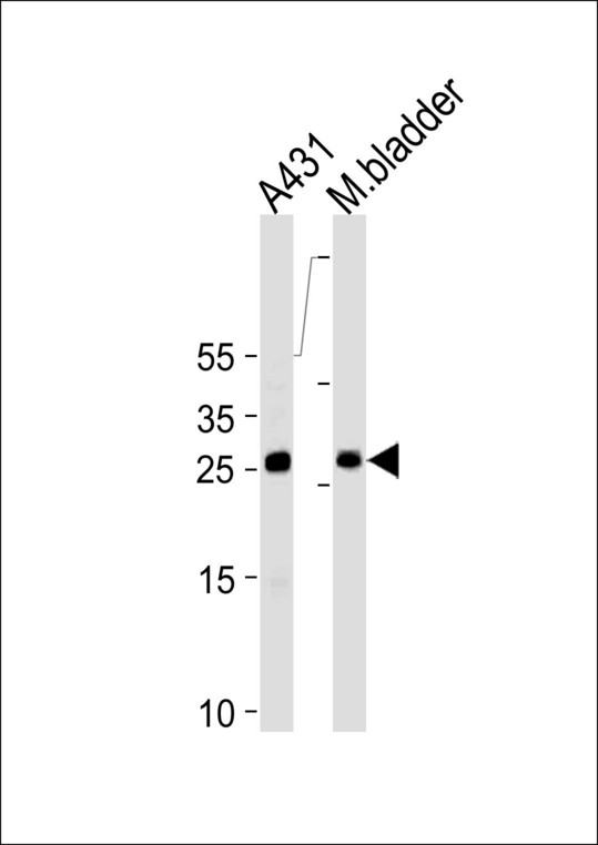 SFN Antibody western blot of A431 cell line and mouse bladder tissue lysates (35 ug/lane). The SFN antibody detected the SFN protein (arrow).