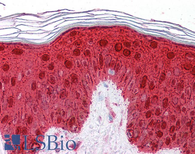 Anti-SFN / 14-3-3 Sigma antibody IHC of human skin. Immunohistochemistry of formalin-fixed, paraffin-embedded tissue after heat-induced antigen retrieval. Antibody LS-B5855 concentration 2.5 ug/ml.