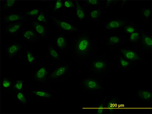 Immunofluorescence of monoclonal antibody to SFPQ on HeLa cell. [antibody concentration 10 ug/ml]