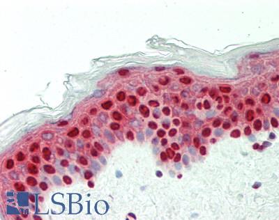 Human Skin: Formalin-Fixed, Paraffin-Embedded (FFPE)