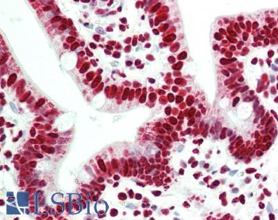 Human Small Intestine: Formalin-Fixed, Paraffin-Embedded (FFPE)