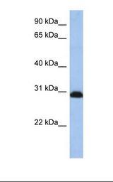 HepG2 cell lysate. Antibody concentration: 1.0 ug/ml. Gel concentration: 12%.