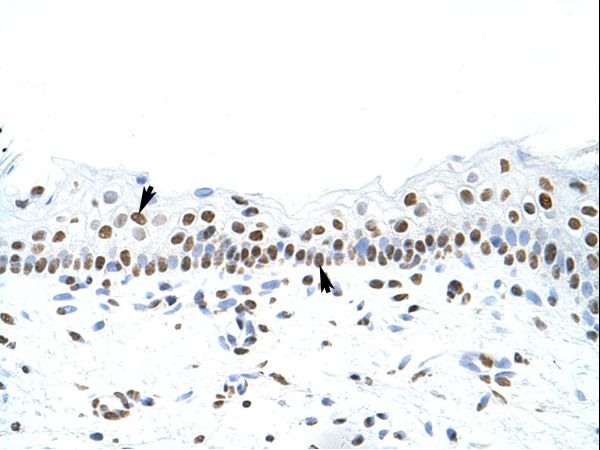 SFPQ antibody LS-C31760 was used in IHC to stain formalin-fixed, paraffin-embedded human skin.