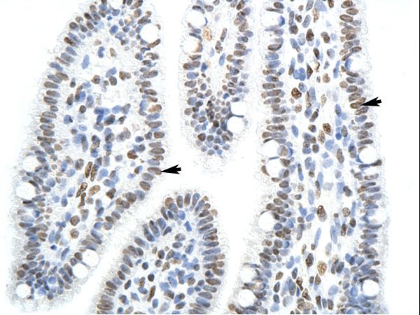 SFPQ antibody LS-C31760 was used in IHC to stain formalin-fixed, paraffin-embedded human intestine.