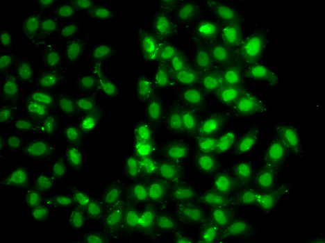 Immunofluorescence blot of U20S cell using PSMD8 antibody.