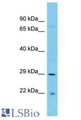 SFR1 / C10orf78 antibody Western Blot of COLO205. Antibody dilution: 1 ug/ml.