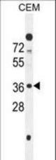 C10orf78 Antibody western blot of CEM cell line lysates (35 ug/lane). The C10orf78 antibody detected the C10orf78 protein (arrow).