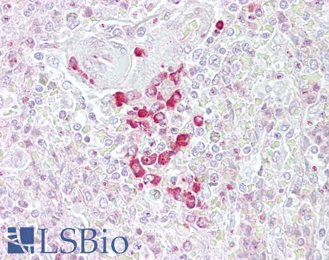 Anti-FRZB antibody IHC of human spleen. Immunohistochemistry of formalin-fixed, paraffin-embedded tissue after heat-induced antigen retrieval. Antibody LS-B6898 concentration 5 ug/ml.