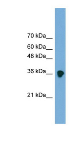 FRZB antibody LS-B6898 Western blot of Transfected 293T cell lysate.