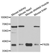 Western blot analysis of extracts of various cell lines, using FRZB antibody.