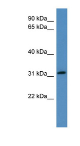 FRZB antibody LS-C135316 Western blot of Fetal Kidney lysate.