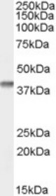 Antibody (0.1 ug/ml) staining of Human Duodenum lysate (35 ug protein in RIPA buffer). Primary incubation was 1 hour. Detected by chemiluminescence.