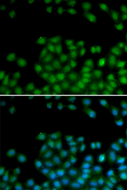 Immunofluorescence blot of HeLa cell using SFRP2 antibody. Blue: DAPI for nuclear staining.