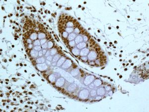 IHC of paraffin-embedded human colon tissue using anti-SF2 antibody.