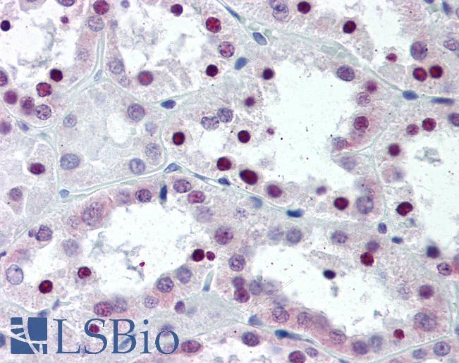 Anti-SF2 antibody IHC of human kidney. Immunohistochemistry of formalin-fixed, paraffin-embedded tissue after heat-induced antigen retrieval. Antibody LS-B2340 concentration 5 ug/ml.