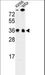 Western blot of SFRS1 Antibody in A2058, WiDr cell line lysates (35 ug/lane). SFRS1 (arrow) was detected using the purified antibody.