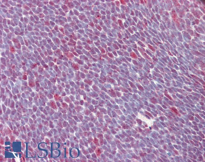 Anti-SF2 antibody IHC of human thymus. Immunohistochemistry of formalin-fixed, paraffin-embedded tissue after heat-induced antigen retrieval. Antibody LS-B3263 concentration 10 ug/ml.