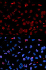 Immunofluorescence analysis of U2OS cell using SFRS1 antibody. Blue: DAPI for nuclear staining.
