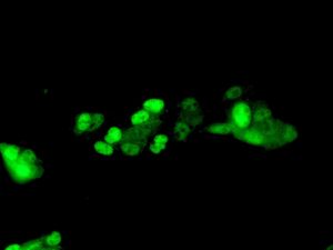 Immunofluorescent staining of HepG2 cells using anti-SF2 antibody.