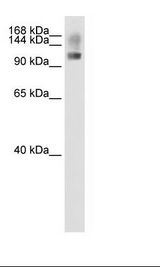 Transfected 293T Cell Lysate