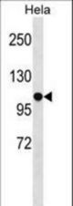 SFRS8 Antibody western blot of HeLa cell line lysates (35 ug/lane). The SFRS8 antibody detected the SFRS8 protein (arrow).