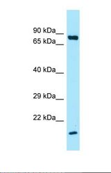 Western blot of Human HCT15. SFTPA1 antibody dilution 1.0 ug/ml.