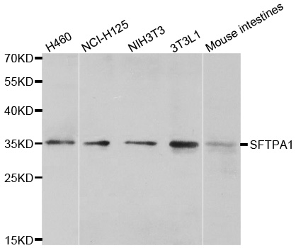 Western blot analysis of extracts of various cell lines, using SFTPA1antibody.