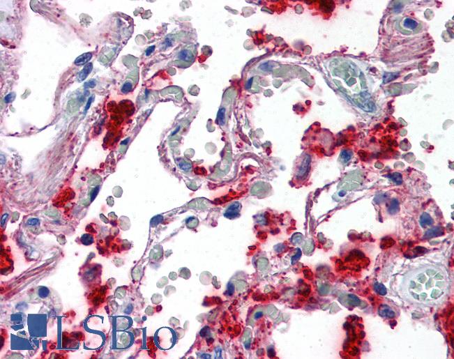 Anti-SFTPA1 / Surfactant Protein A antibody IHC of human lung. Immunohistochemistry of formalin-fixed, paraffin-embedded tissue after heat-induced antigen retrieval. Antibody LS-B2543 concentration 10 ug/ml.