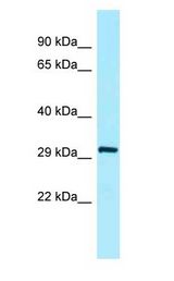 SFTPA2 antibody Western Blot of Fetal Heart.