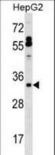 SFTPB Antibody western blot of HepG2 cell line lysates (35 ug/lane). The SFTPB antibody detected the SFTPB protein (arrow).