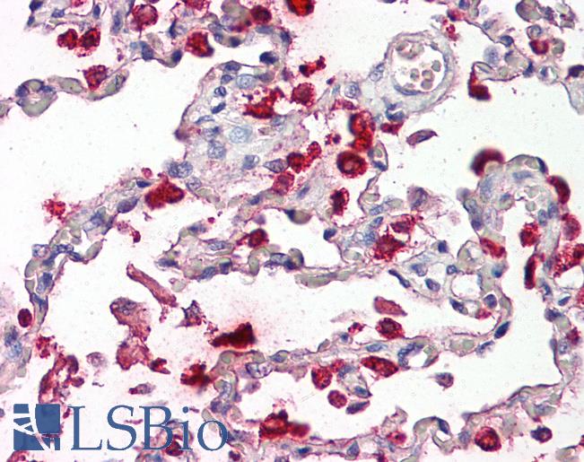 Anti-Surfactant Protein B / SP-B antibody IHC of human lung. Immunohistochemistry of formalin-fixed, paraffin-embedded tissue after heat-induced antigen retrieval. Antibody LS-B8081 dilution 2.5-5 ug/ml.